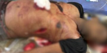 a violent clash between tdp and ysrcp workers in kakinada district left one dead and four injured, police have launched a probe.