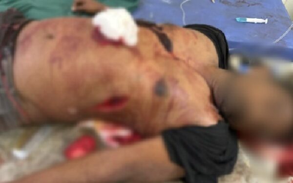 a violent clash between tdp and ysrcp workers in kakinada district left one dead and four injured, police have launched a probe.