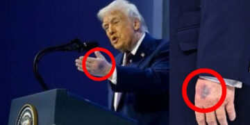 Donald Trump hand injury seen during Davos event