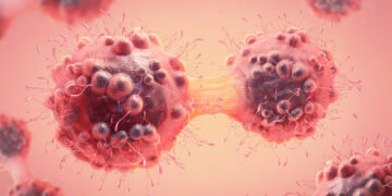 FMT capsules boosting immunity for lung and skin cancer patients