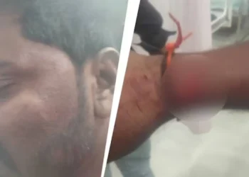 Police control scene at Koppal after mob attack on Hindu man