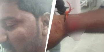 Police control scene at Koppal after mob attack on Hindu man